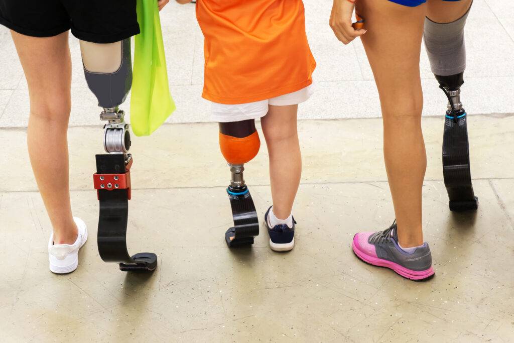 Orthotics and Prosthetics make a difference to people of all ages